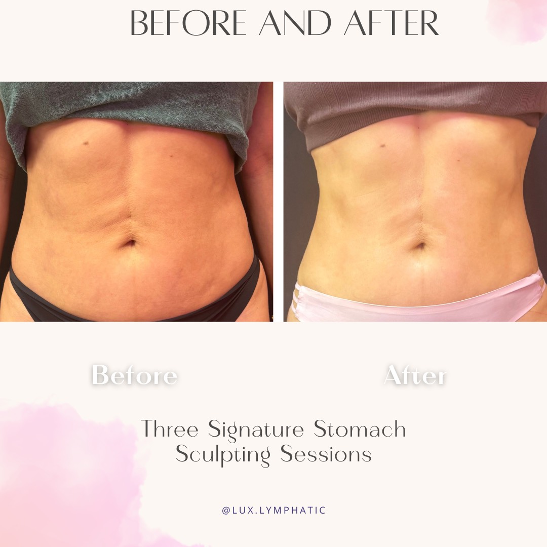 Three Signature Stomach Sculpting Sessions