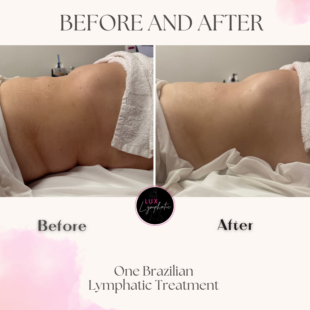 One Lymphatic Massage Session - Back View